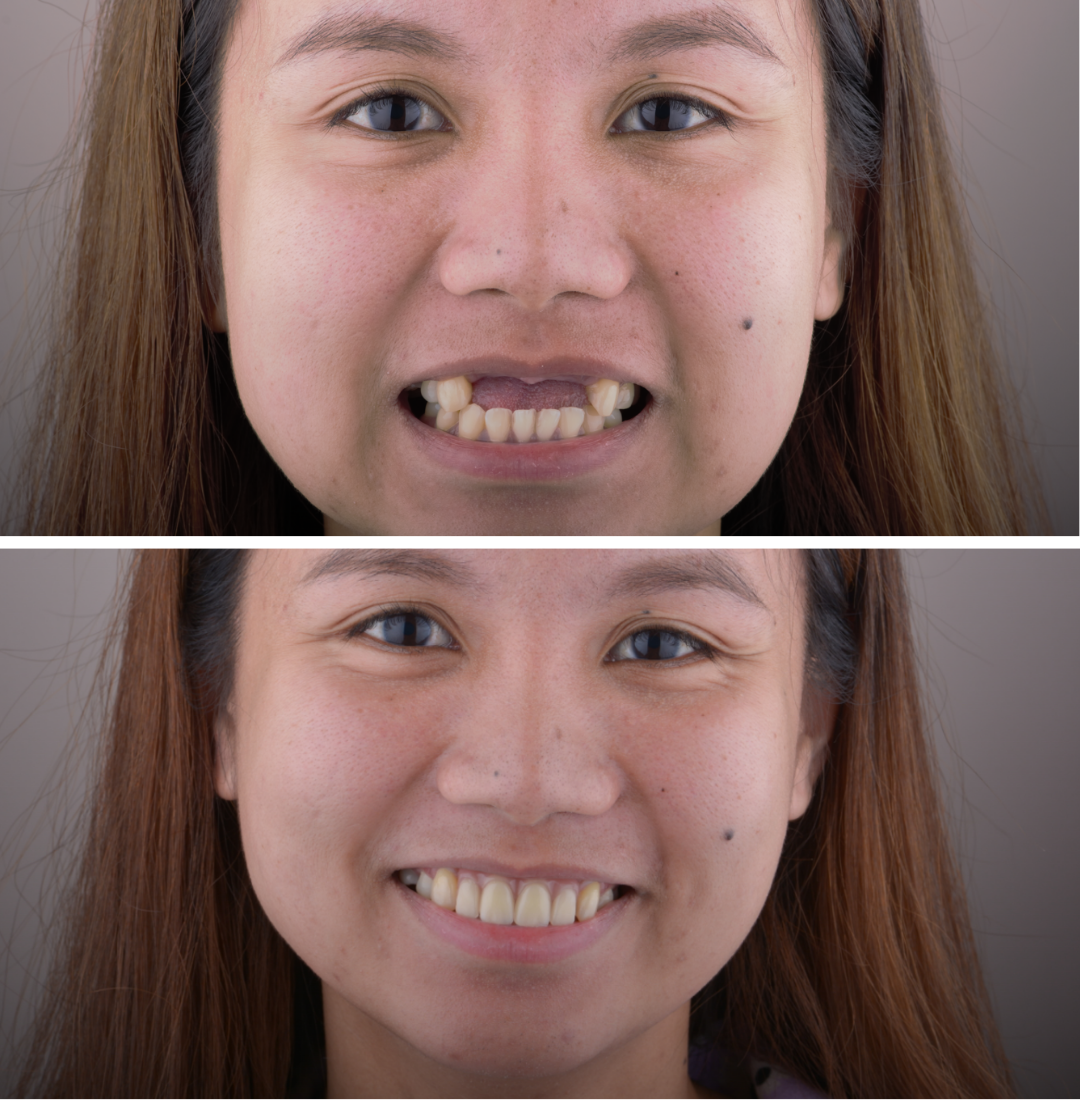 Smile Restoration Image